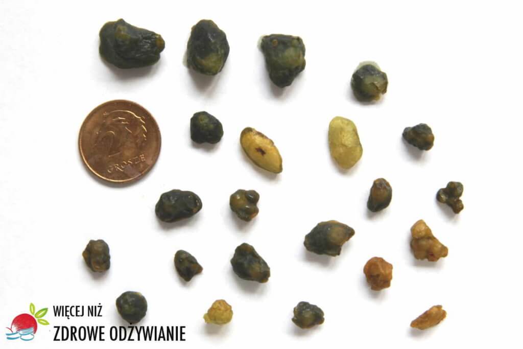 Oczyszczanie wątroby Oczyszczanie wątroby